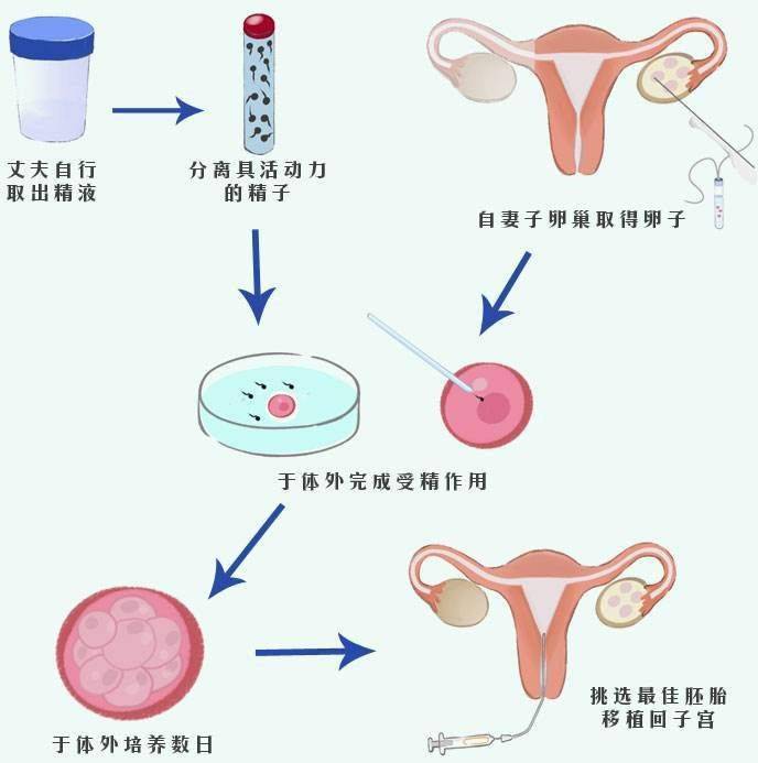 贵阳高薪招聘捐卵志愿者